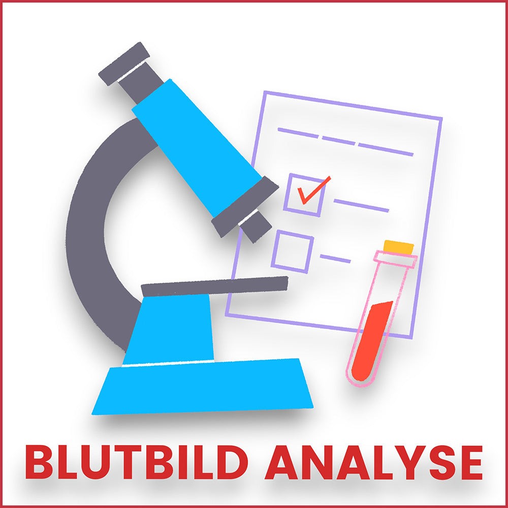 Selbsttest für Zuhause zur Blutuntersuchung - blutbild, kleines blutbild, großes blutbild, nutri gene, selbsttest, gesundheitstests, blutuntersuchung, eth meditec, gesundheitsvorsorge, heimatdiagnosetests, blutwertanalyse, gesund bleiben, präventionsmedizin, ernährungsberatung, medizinische tests